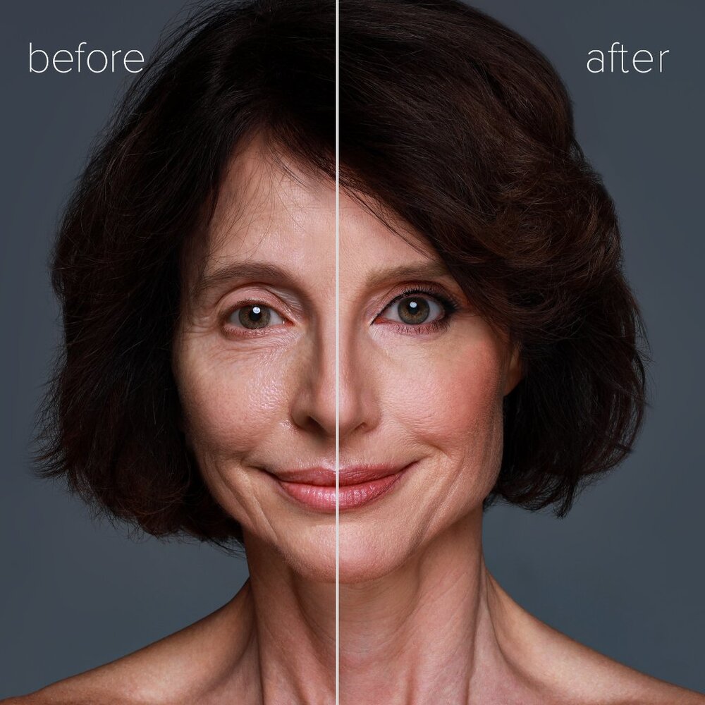 Lajuven – Instant Face Lift - Picture 4 of 7